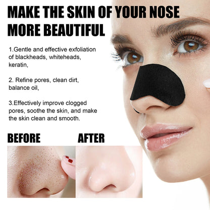 Peel Off Blackheads Remove Plaster Nose Strips Pull Black Mask for Women Beauty Oily Skin Face Care Remove Blackheads